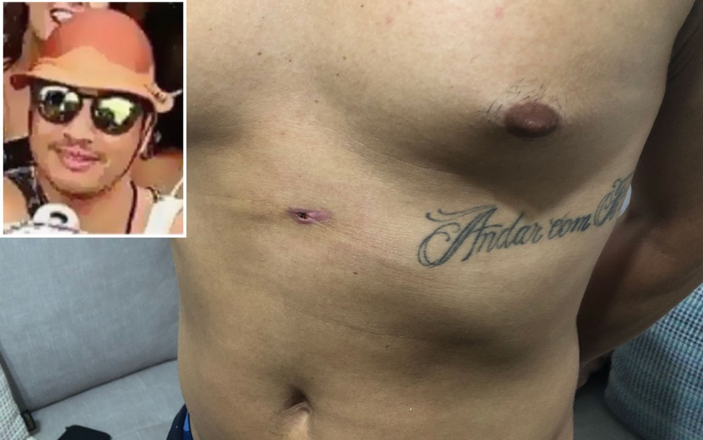 rodrigo-beralde-foto-tiro