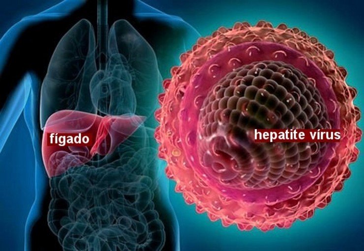 hepatite-a